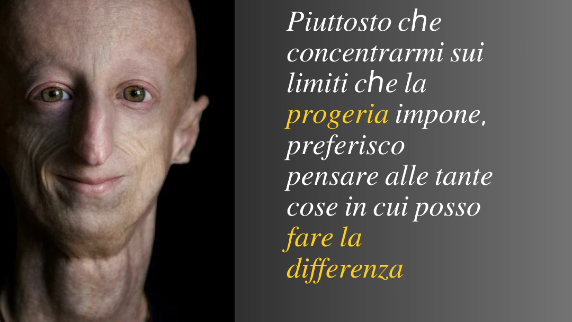Intitolata a Sammy Basso la prima scuola d’Italia. Patriciello: “La sua vita esempio di coraggio”.